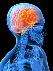 عکس اشعه ایکس مغز انسان